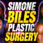 simone biles plastic surgery